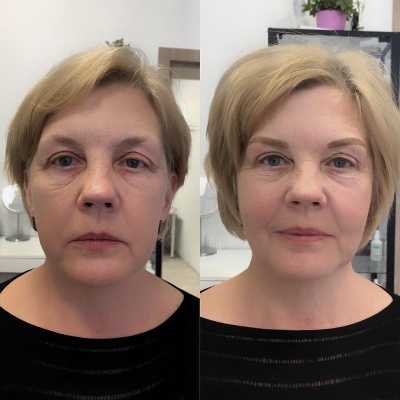 перманентный макияж до и после